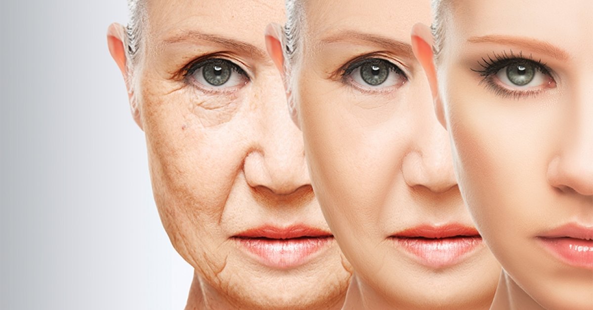 24 karátos arcbőr kezelés
